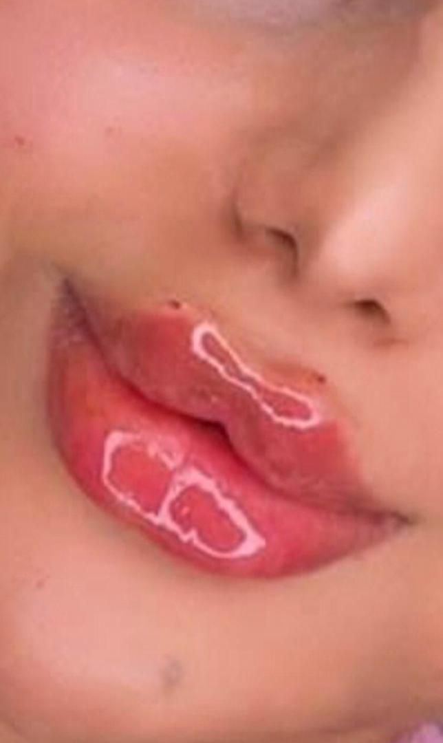 تزریق ژل فیلر مزوژل جوانساز بوتاکس لب روسی مزو مو|خدمات آرایشگری و زیبایی|کرج, گلشهر|دیوار