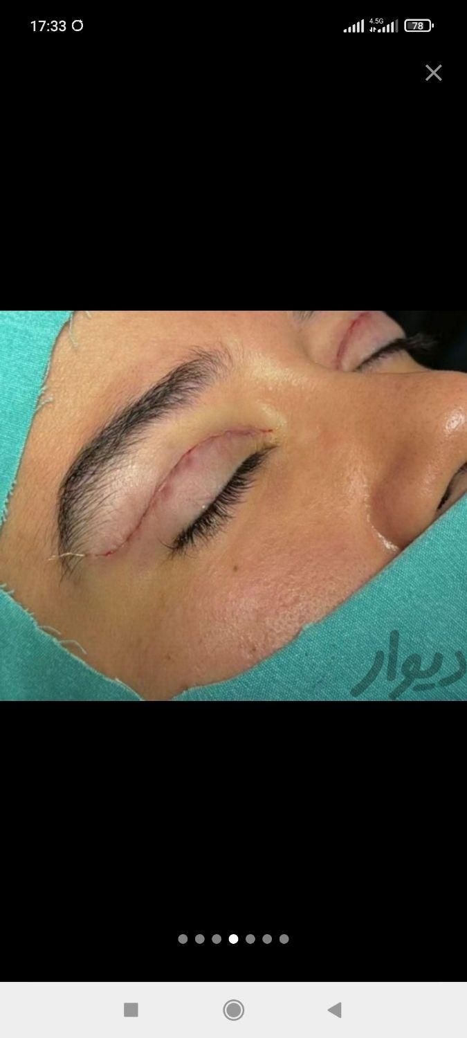 لیپوساکشن ،پیکرتراشی، جراحی زیبایی ،ابدومینوپلاستی|خدمات آرایشگری و زیبایی|تهران, شهرآرا|دیوار