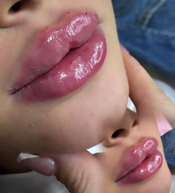 جشنواره ژل و بوتاکس 30درصد تخفیف|خدمات آرایشگری و زیبایی|کوهدشت, |دیوار