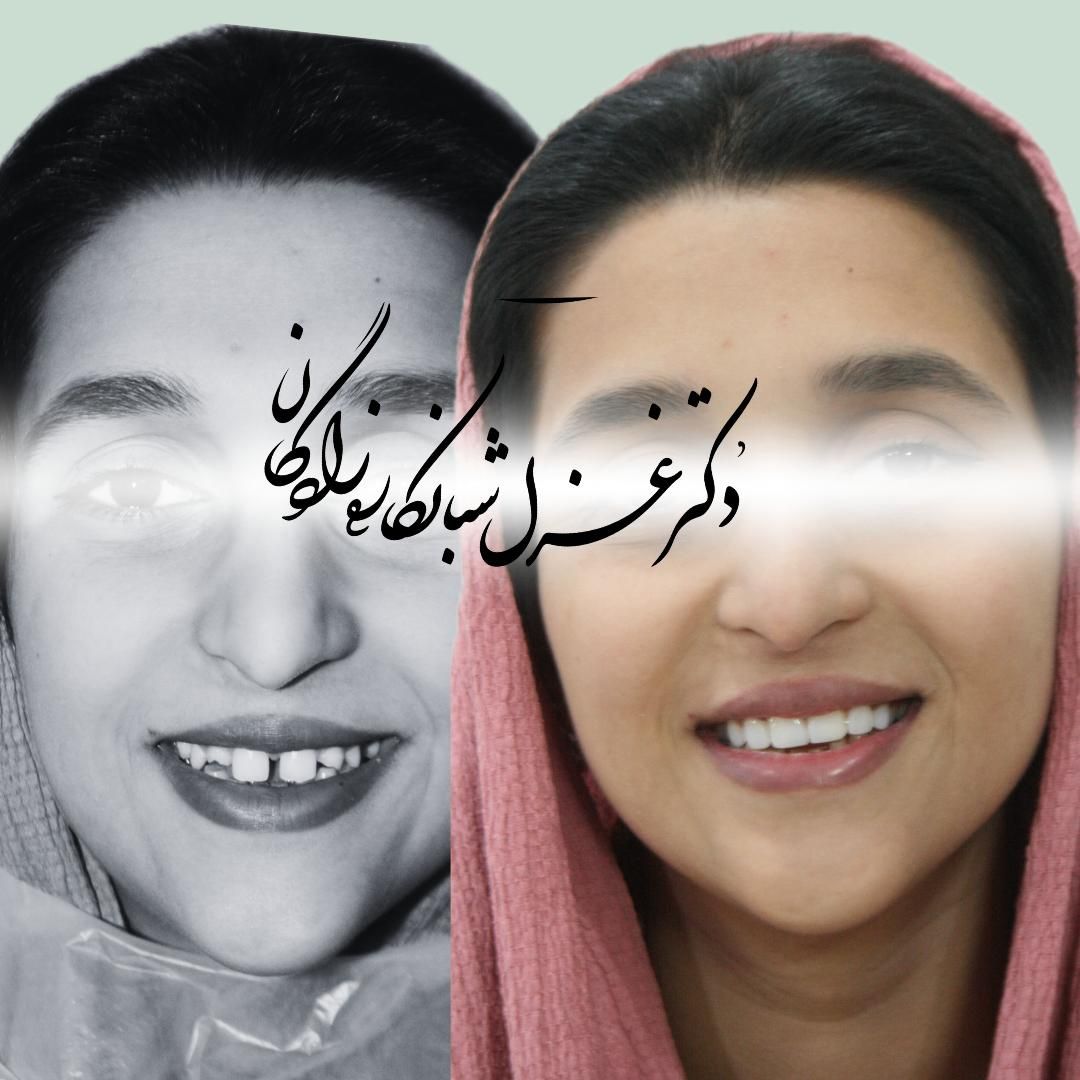 ارتودنسی با شرایط اقساط و منعطف|خدمات آرایشگری و زیبایی|تهران, دزاشیب|دیوار