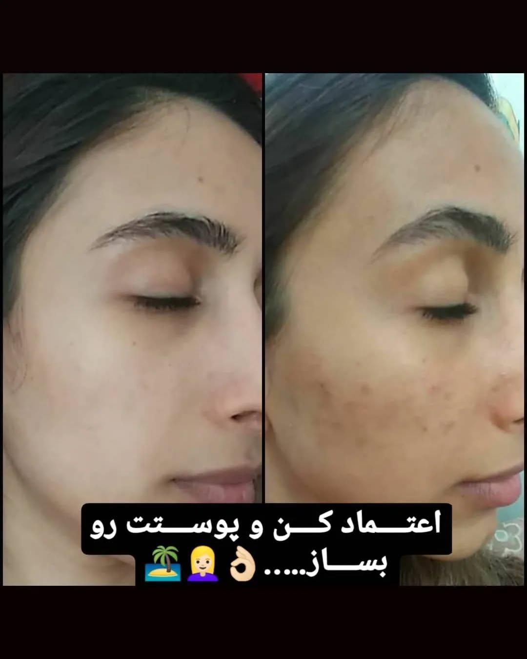 کرم وی آی پی (VIP) اصل|آرایشی، بهداشتی، درمانی|تهران, زعفرانیه|دیوار
