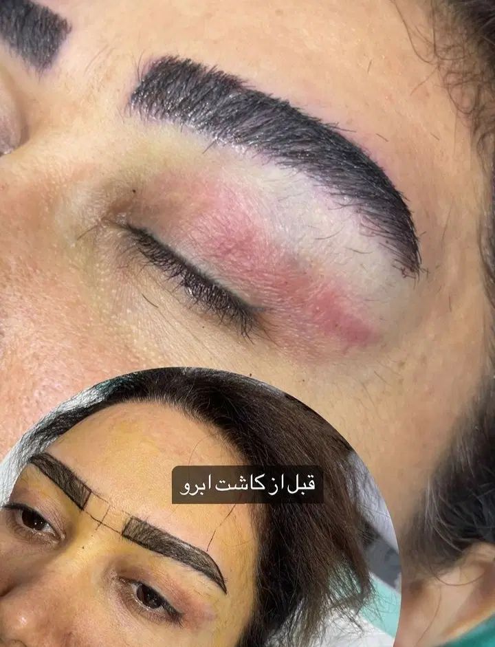 مدل کاشت ابرو|خدمات آرایشگری و زیبایی|تهران, الهیه|دیوار
