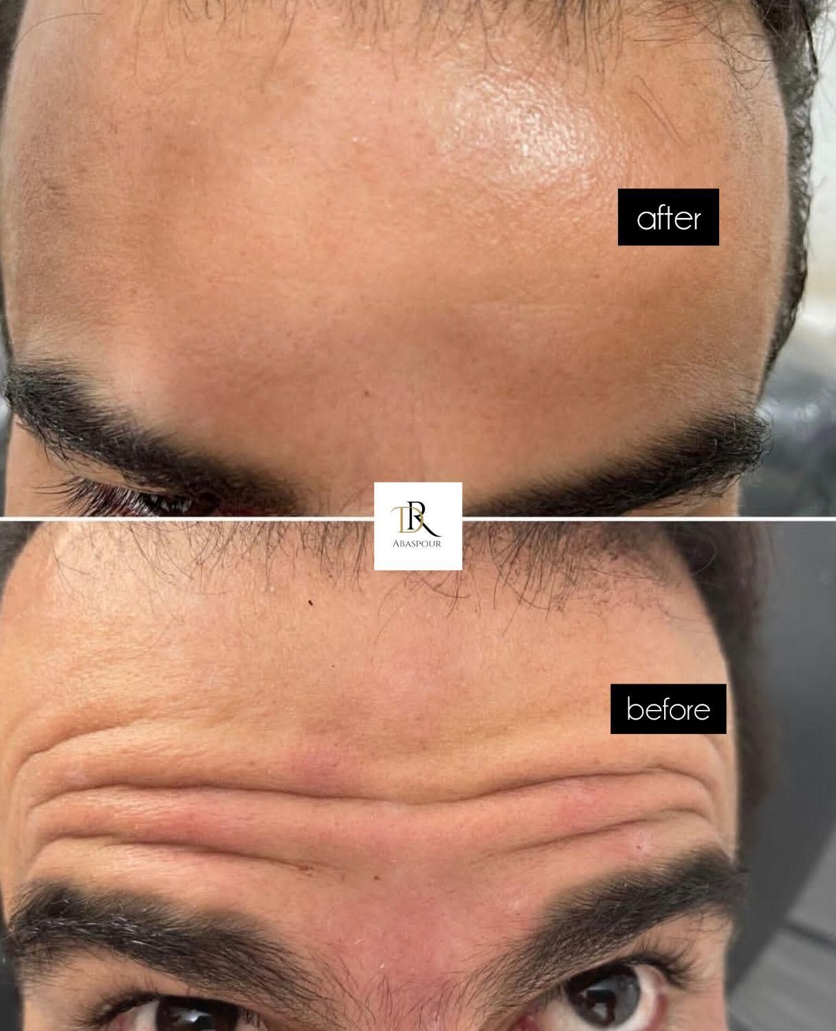 جشنواره ژل و بوتاکس|خدمات آرایشگری و زیبایی|اصفهان, مرداویج|دیوار