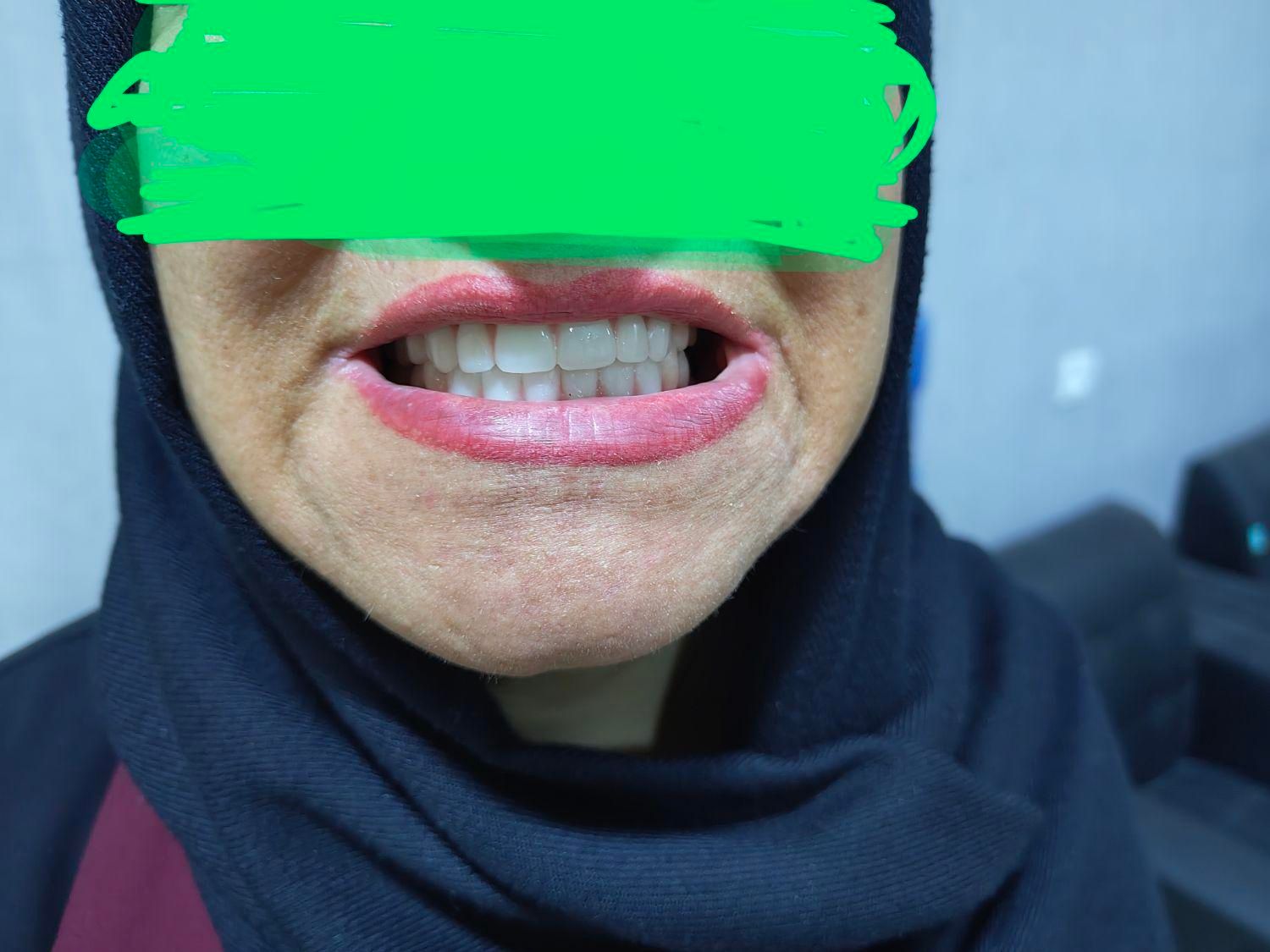 لابراتوار دندان مصنوعی|خدمات آرایشگری و زیبایی|جم, |دیوار