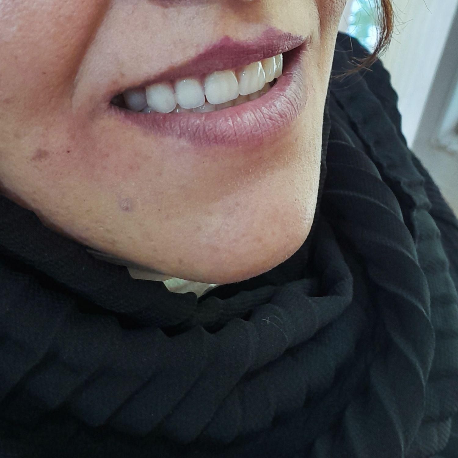 دندانسازی ، دندان مصنوعی|پزشکی|اصفهان, شاهد|دیوار