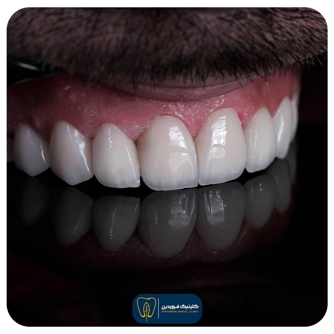 منشی و کال سنتر دندانپزشکی|استخدام درمانی، زیبایی، بهداشتی|تهران, خرمشهر|دیوار