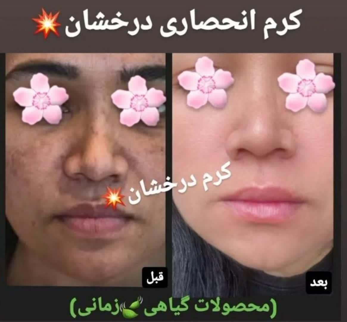 (کرم ضدلک و روشن کننده درخشان)بدون بازگشت|آرایشی، بهداشتی، درمانی|شیراز, قصرالدشت|دیوار