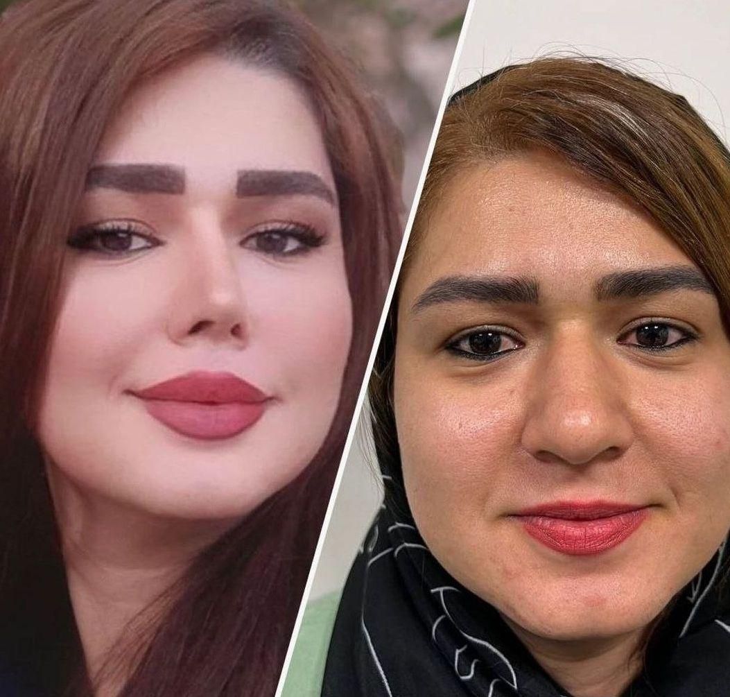جشنواره ویژه عمل زیبایی بینی توسط متخصص|خدمات آرایشگری و زیبایی|اهواز, کیانپارس |دیوار