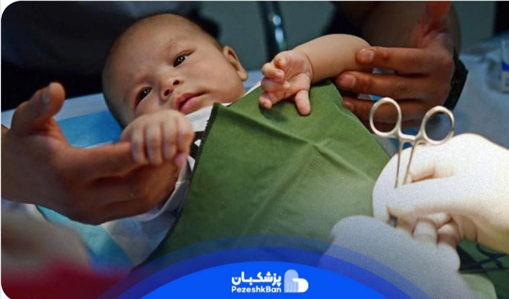 ختنه در منزل با دستگاه لیزر|خدمات آرایشگری و زیبایی|زاهدان, |دیوار