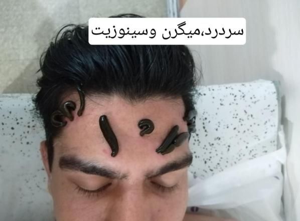 طب سوزنی بادکش گرم مشاوره تغذیه حجامت عام زالو|خدمات آرایشگری و زیبایی|اصفهان, ملکشهر|دیوار