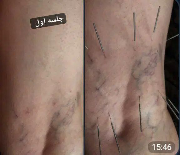 راهنمای میکنم برای واریس|فعالیت داوطلبانه تحقیقاتی|تهران, والفجر (افسریه)|دیوار