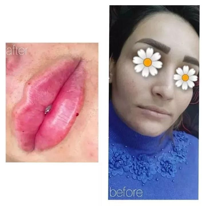 زیبایی ژل و بوتاکس|خدمات آرایشگری و زیبایی|اهواز, کیان اباد|دیوار
