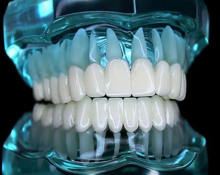 آموزش تخصصی پرسلن دندان(پودرگذاری)|خدمات آموزشی|اصفهان, همدانیان|دیوار