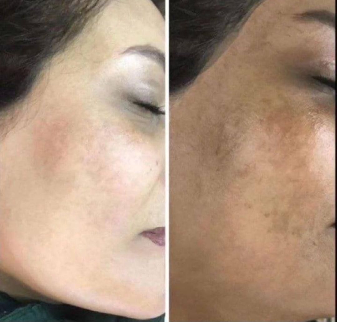 گیاهی روشن کننده ضدلک ۳ روز|خدمات آرایشگری و زیبایی|ایرانشهر, |دیوار