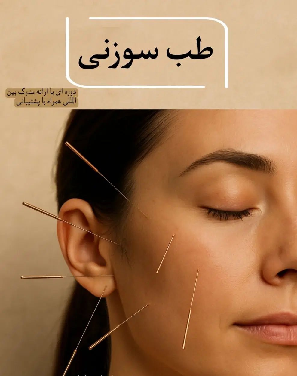 همایش آموزش تخصصی طب سوزنی + مدرک بین‌المللی|گردهمایی و همایش|تهران, پاسداران|دیوار
