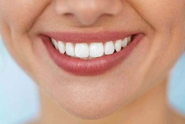کامپوزیت دندان *با سفته*|خدمات آرایشگری و زیبایی|مشهد, هنرستان|دیوار