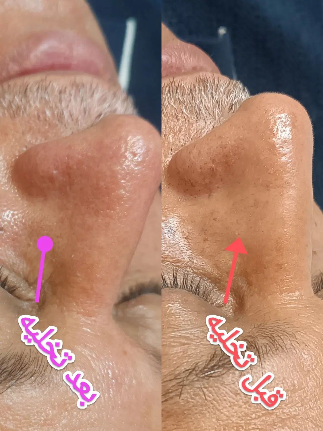 تزریق هرنوع خدمات زیبایی به صورت تضمینی|خدمات آرایشگری و زیبایی|کارون, |دیوار