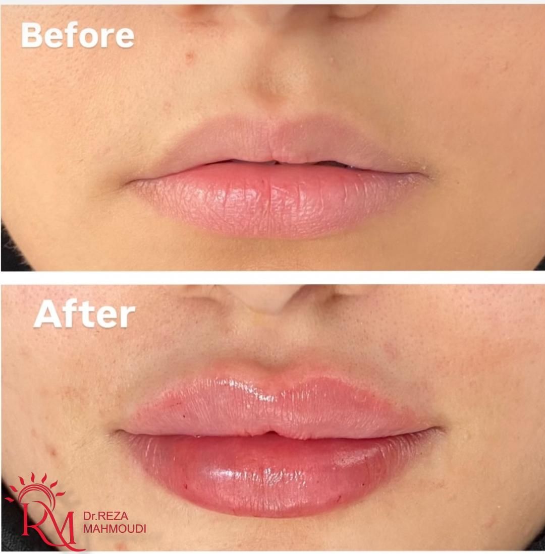 جشنواره  زیبایی کلینیک دکتر محمودی|خدمات آرایشگری و زیبایی|کرمان, |دیوار