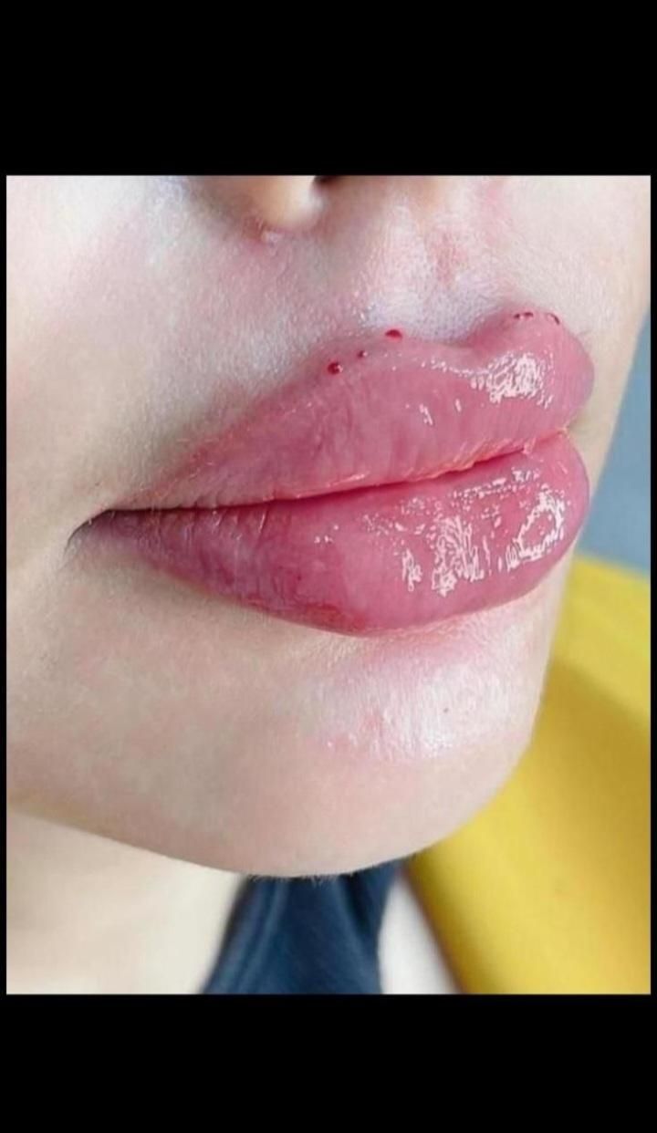 ژل لب|خدمات آرایشگری و زیبایی|اسلامشهر, شهرک مهدیه|دیوار