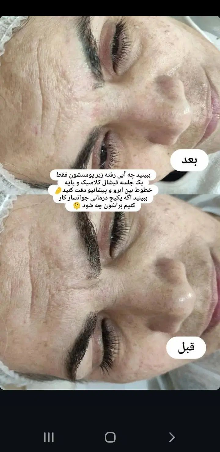فشیال صورت ودست|خدمات آرایشگری و زیبایی|تهران, زاهد گیلانی|دیوار
