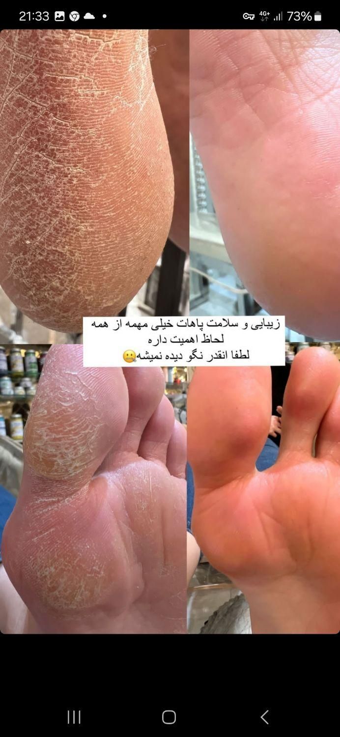 کاشت ناخن ، اسپا ،پارافین تراپی و آموزش همه موارد|خدمات آرایشگری و زیبایی|شیراز, معالی‌آباد|دیوار
