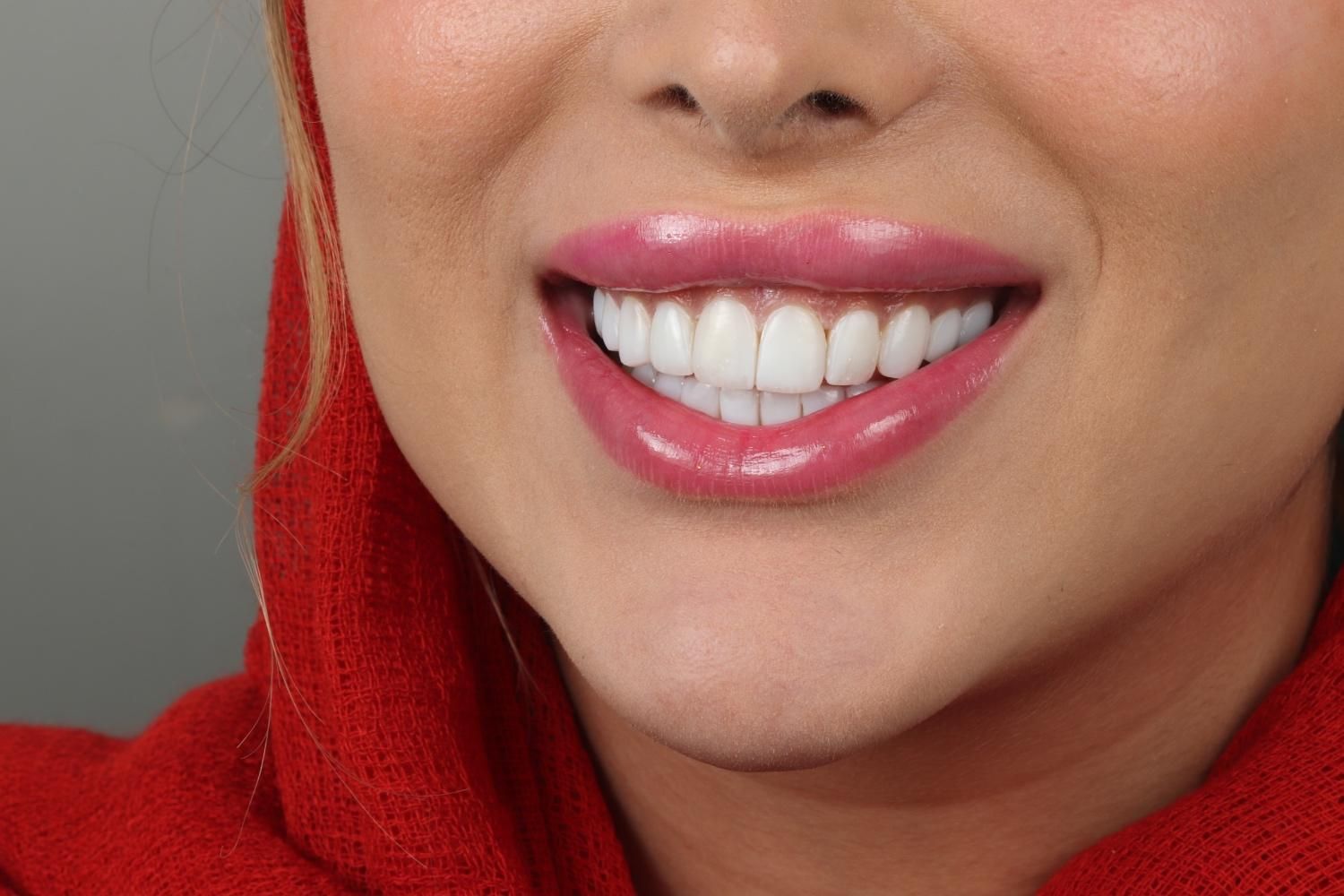 پذیرش و دستیاردندانپزشکی با سابقه کاردر دندانپزشکی|استخدام درمانی، زیبایی، بهداشتی|تهران, دریا|دیوار
