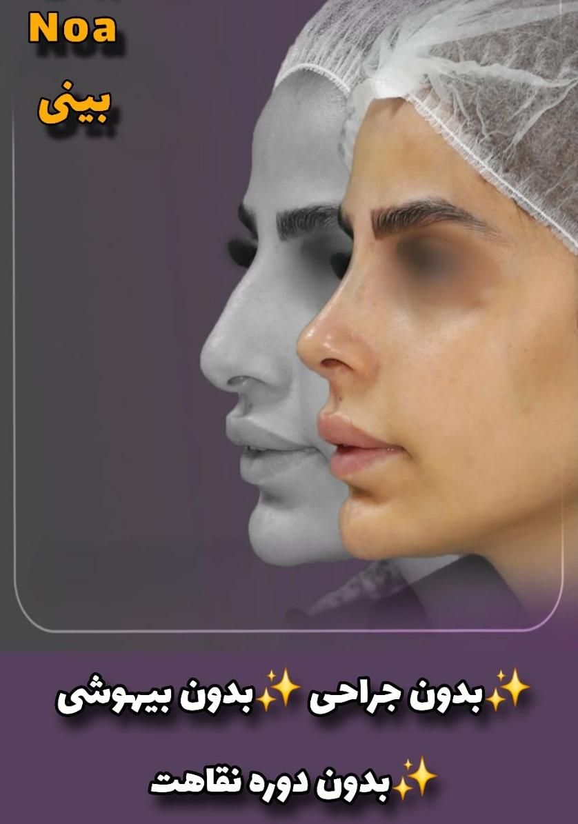 جشنواره جوانسازی Max Lift پزشک پوست مو بینی زیبایی|خدمات آرایشگری و زیبایی|مشهد, هفت تیر (حافظ)|دیوار
