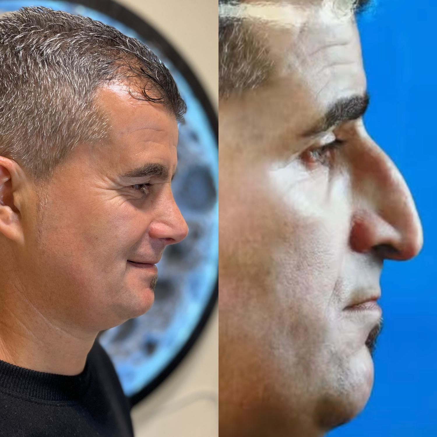 جشنواره عمل بینی فقط با ۲۵ میلیون|خدمات آرایشگری و زیبایی|رشت, رشتیان|دیوار