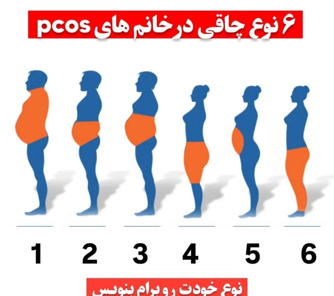 پکیج لاغری با ایمبیدینگ و طب سوزنی رایگان|خدمات آرایشگری و زیبایی|اصفهان, بوستان آینه خانه|دیوار