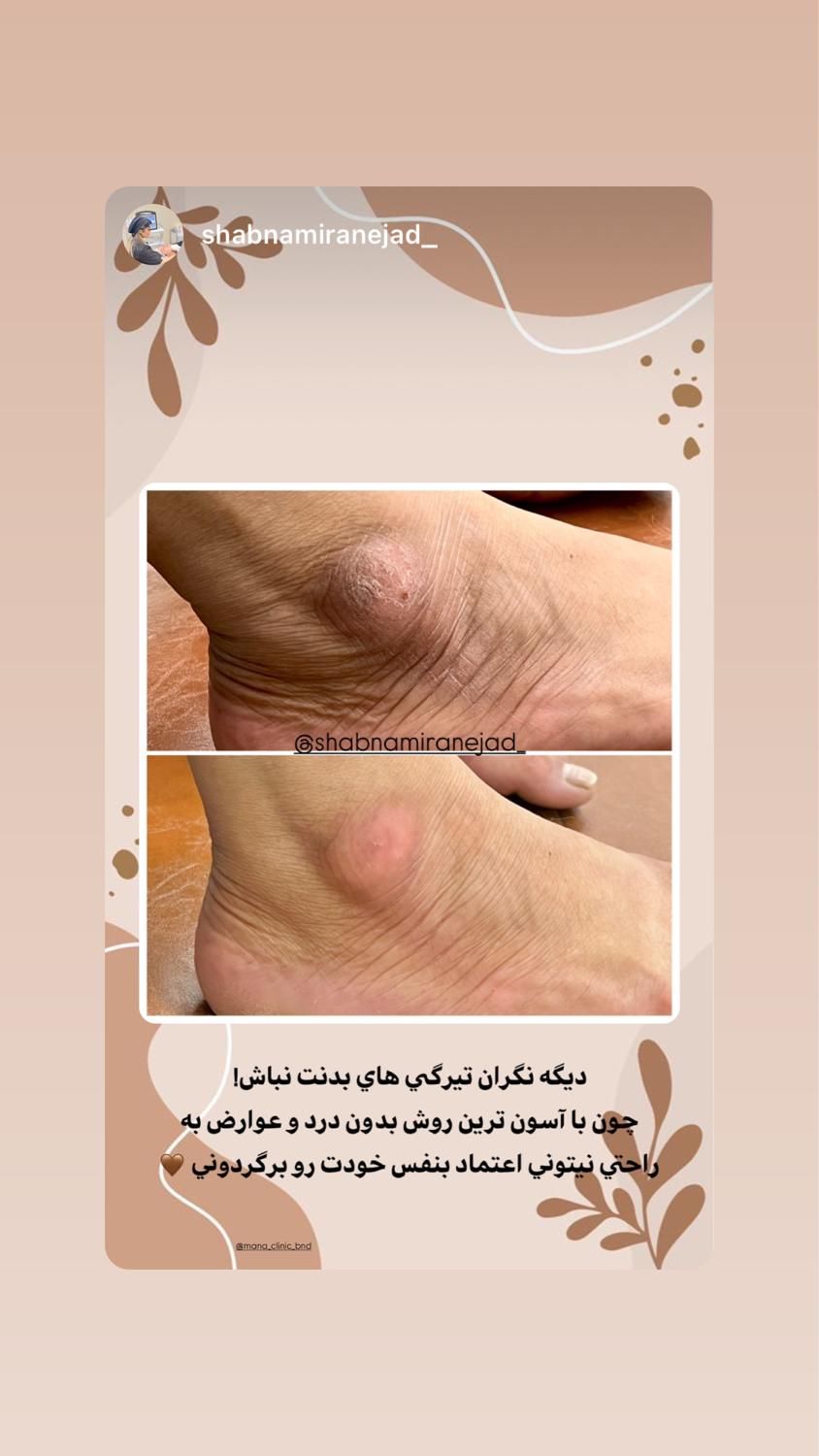 فرصت طلایی برای تزریق ژل و انواع فیلر بوتاکس|خدمات آرایشگری و زیبایی|بندرعباس, |دیوار