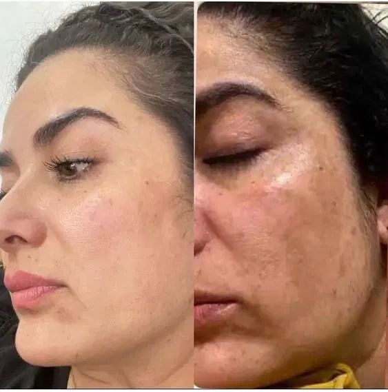آموزش پاکسازی پوست + مدرک بین‌المللی و درآمد بالا|خدمات آموزشی|کرج, جهان‌شهر|دیوار