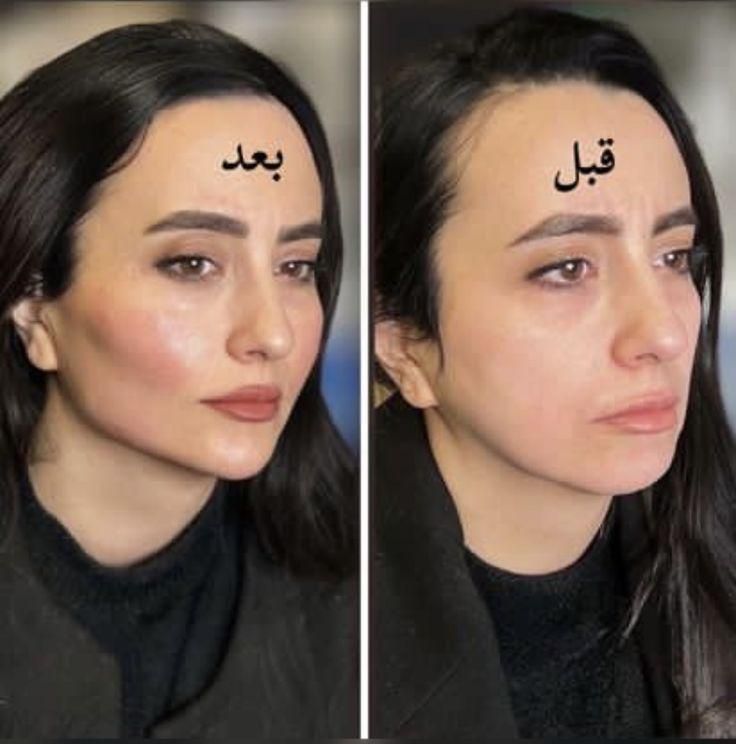 مدل فیشیالcip با دستگاه آنالیز دار و هوش مصنوعی|خدمات آرایشگری و زیبایی|کرج, گلشهر|دیوار