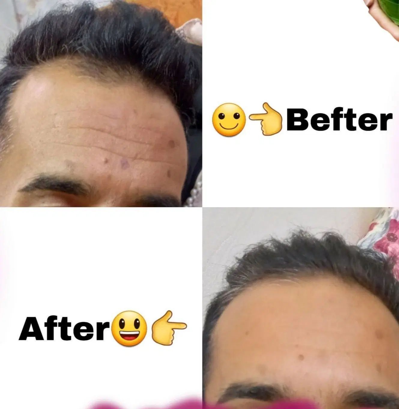 جوانسازی و مراقبت تخصصی پوست بدون تزریق|آرایشی، بهداشتی، درمانی|مشهد, الهیه|دیوار