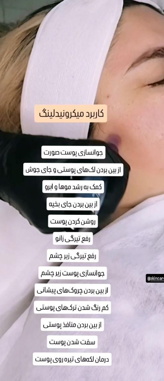 آموزش تخصصی پاکسازی و فیشال پوست با دستگاه با مدرک|خدمات آموزشی|شاهینشهر, عطار|دیوار