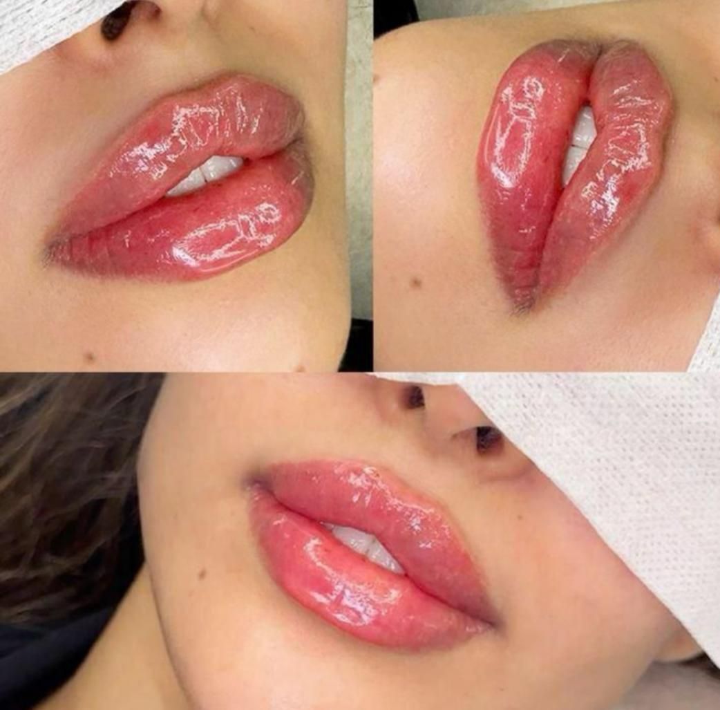 آموزش ژل و بوتاکس. لیفت صورت بانخ (کلینیک)|خدمات آرایشگری و زیبایی|بندرعباس, |دیوار