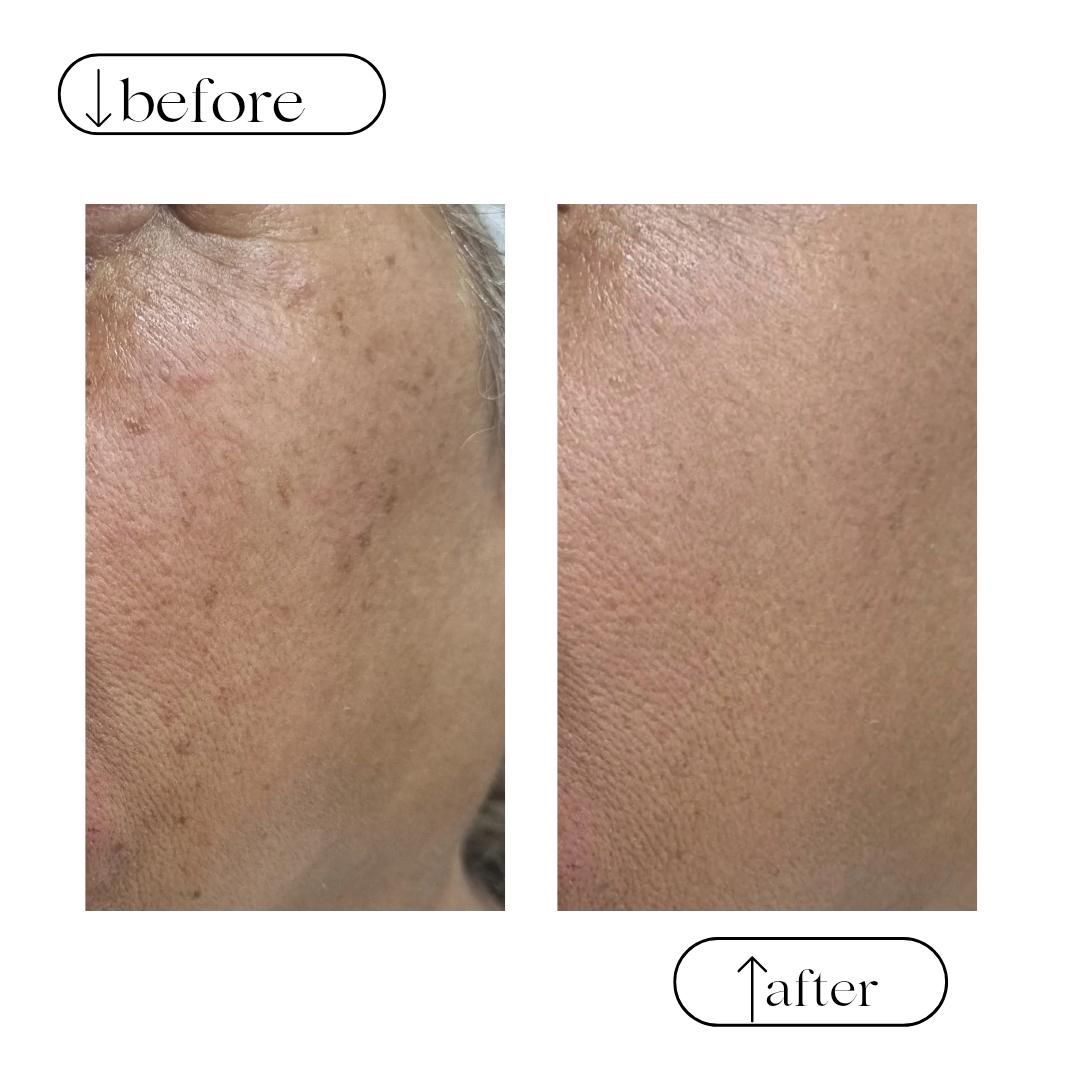 تزریق ژل و بوتاکس، ژل لب روسی و آموزش و ارائه مدرک|خدمات آرایشگری و زیبایی|کرج, شاهین‌ویلا|دیوار
