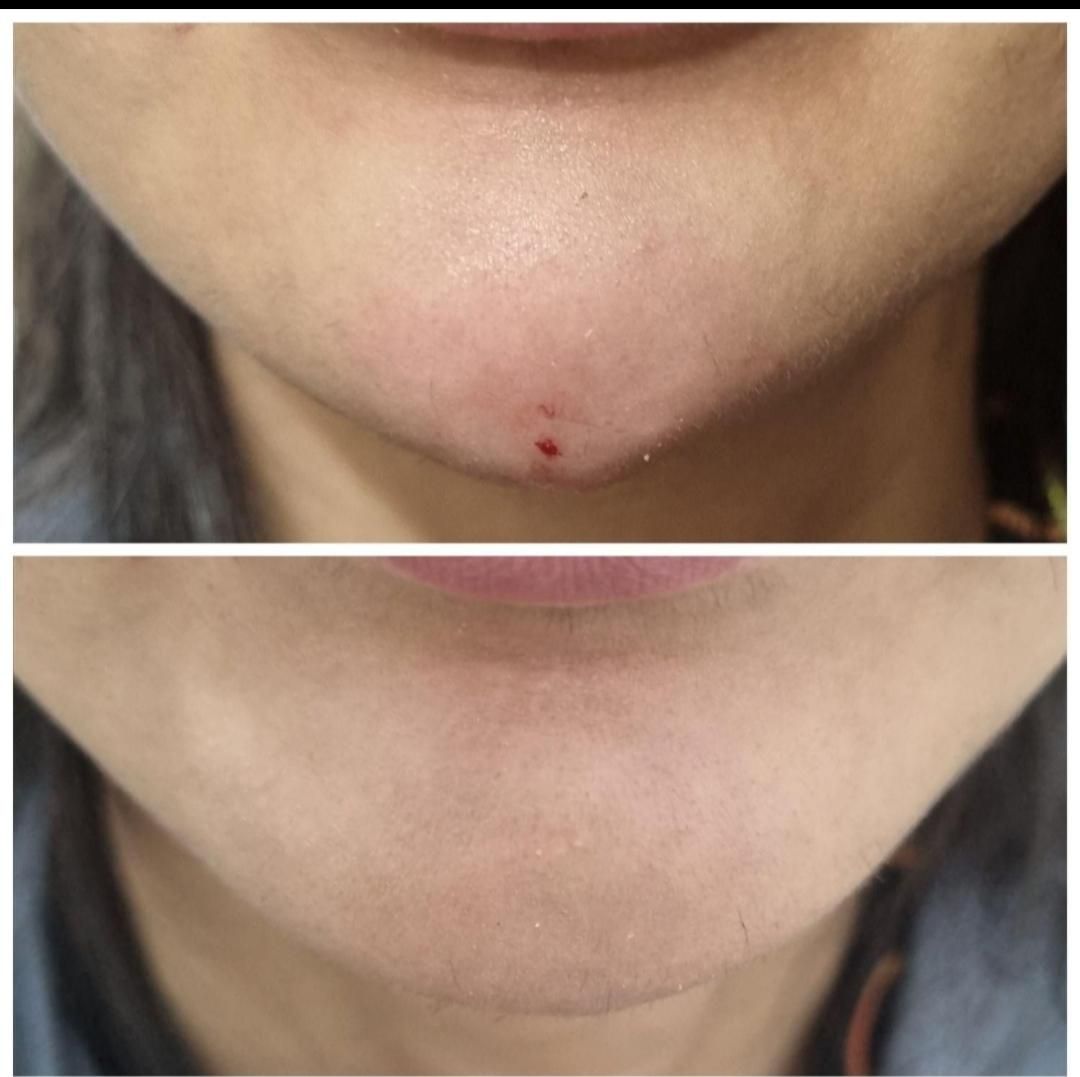 ژل لب و بوتاکس  مدلینگ پرسینگ چالگونه آموزش ژل|خدمات آرایشگری و زیبایی|اهواز, کیانپارس |دیوار