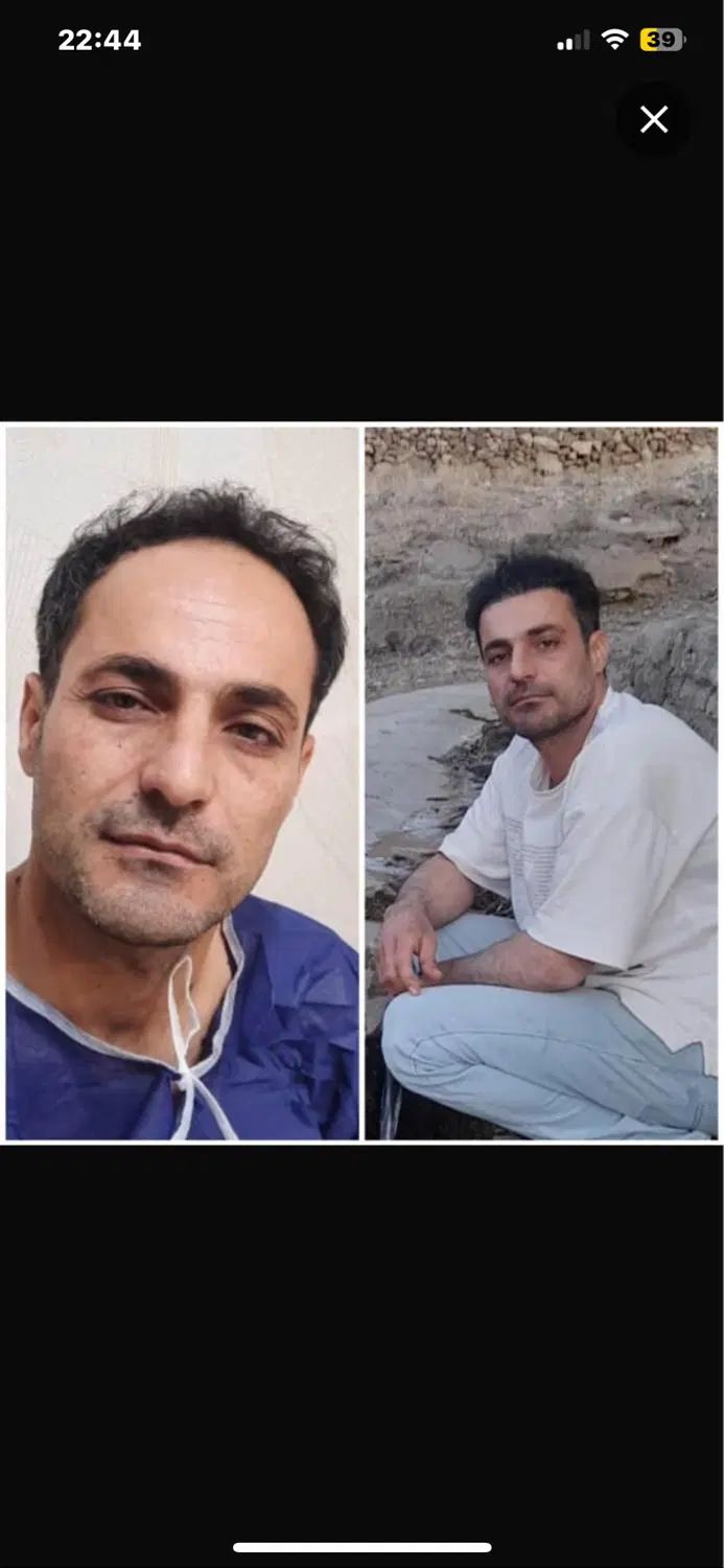 کاشت مو روش سوپر FUE پلاس(روش شیرازی)فقط ۱۵ میلیون|خدمات آرایشگری و زیبایی|یزد, |دیوار