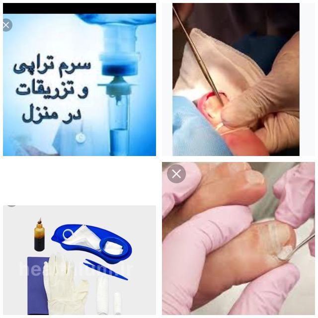 خدمات پرستاری و درمان و برداشتن انواع زگیل|خدمات آرایشگری و زیبایی|یاسوج, |دیوار