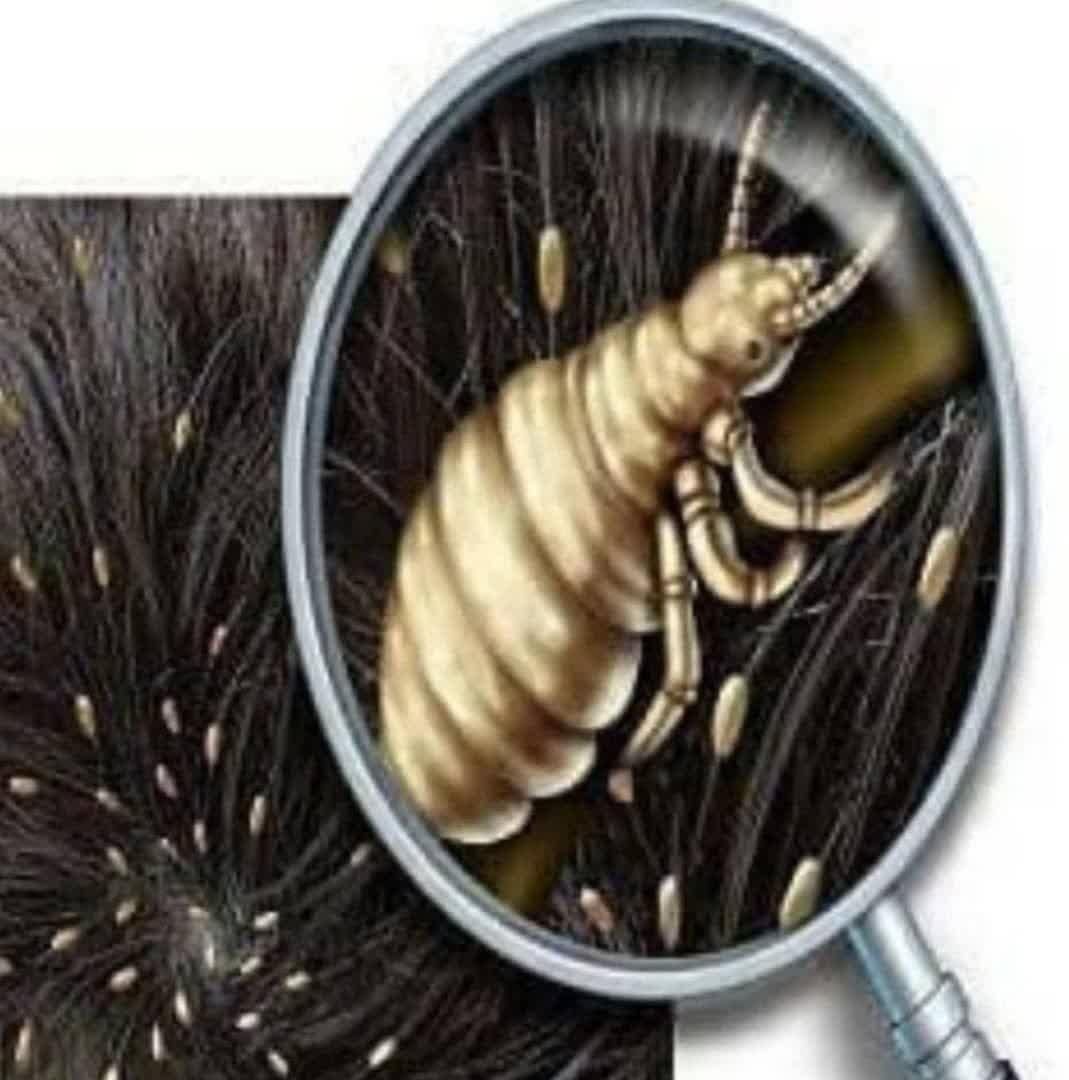 پودر شپش|آرایشی، بهداشتی، درمانی|کرمان, |دیوار