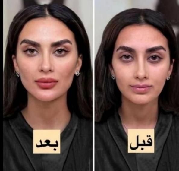آموزش ژل فیلر لب چانه انزیم چاقی صورت مزو مو فشیال|خدمات آرایشگری و زیبایی|قم, زنبیل آباد|دیوار