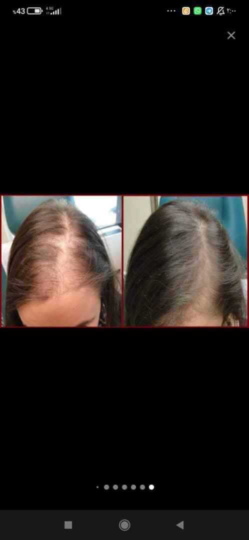 آموزش اسکالپ کف سر و فشیال پوست و کراتین ابریشمی|خدمات آموزشی|خمینی‌شهر, |دیوار