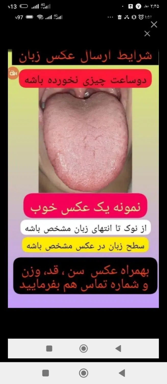 تشخیص بیماریها فقط و فقط از روی تحلیل زبان|خدمات آرایشگری و زیبایی|آستانه اشرفیه, |دیوار