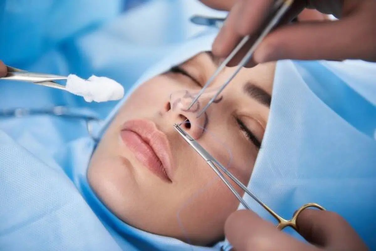 جراحی زیبایی صورت|خدمات آرایشگری و زیبایی|تهران, حصارک|دیوار