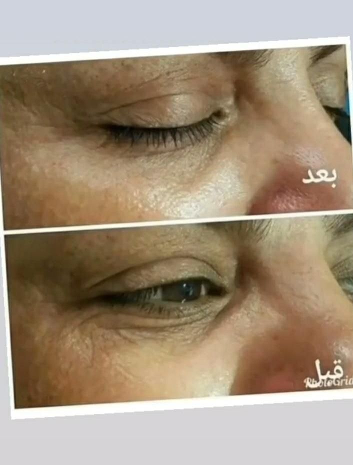 تنها کرم لیفت صورت(نمایندگی رسمی لاکچری کوین)|آرایشی، بهداشتی، درمانی|تهران, ابن بابویه|دیوار
