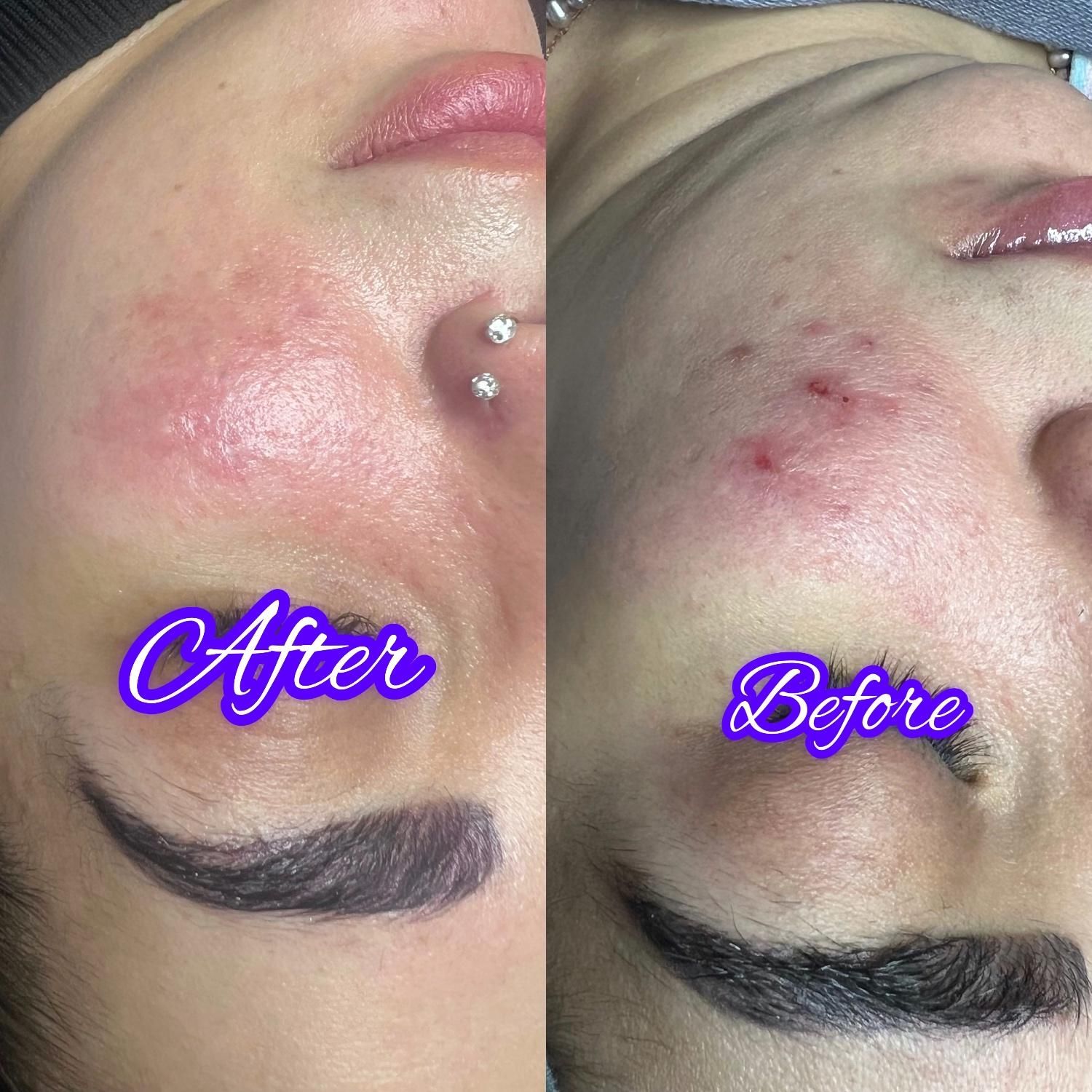 آموزش و خدمات پاکسازی پوست چالوس|خدمات آرایشگری و زیبایی|چالوس, |دیوار