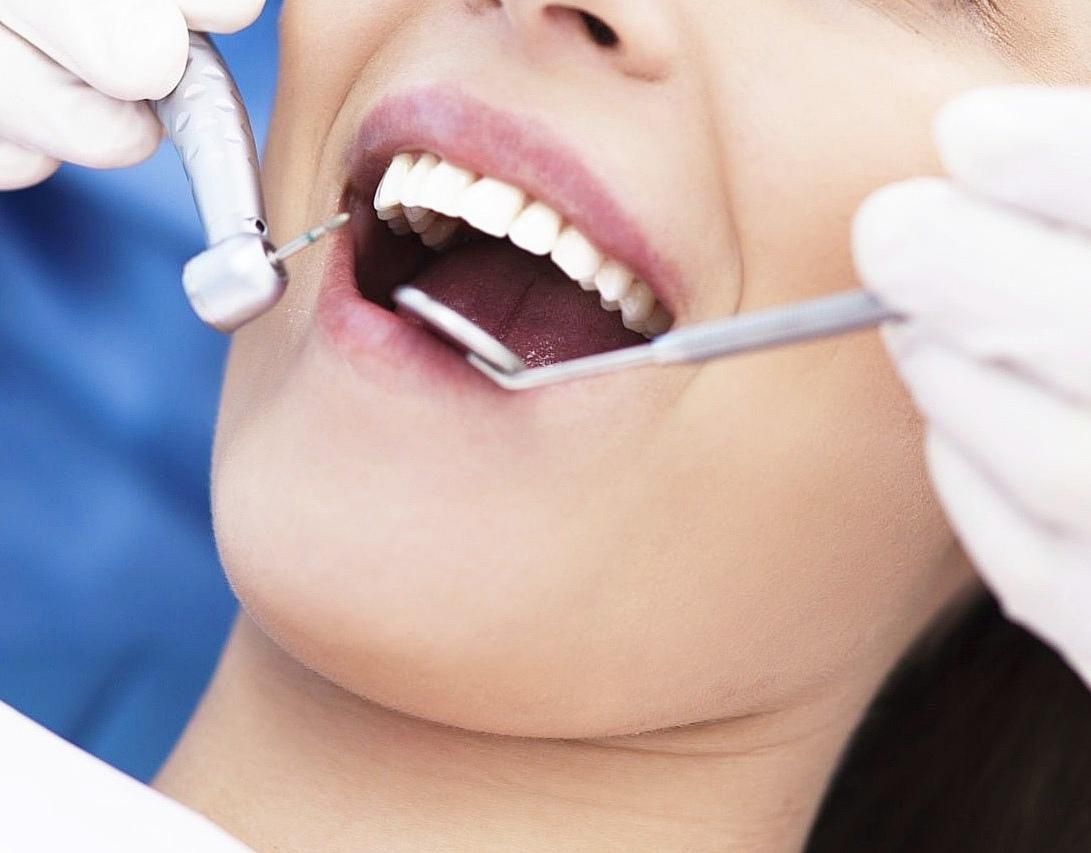 تخفیف های ویژه دندانپزشکی،کامپوزیت زیبایی،عصب کشی|خدمات آرایشگری و زیبایی|آبادان, |دیوار