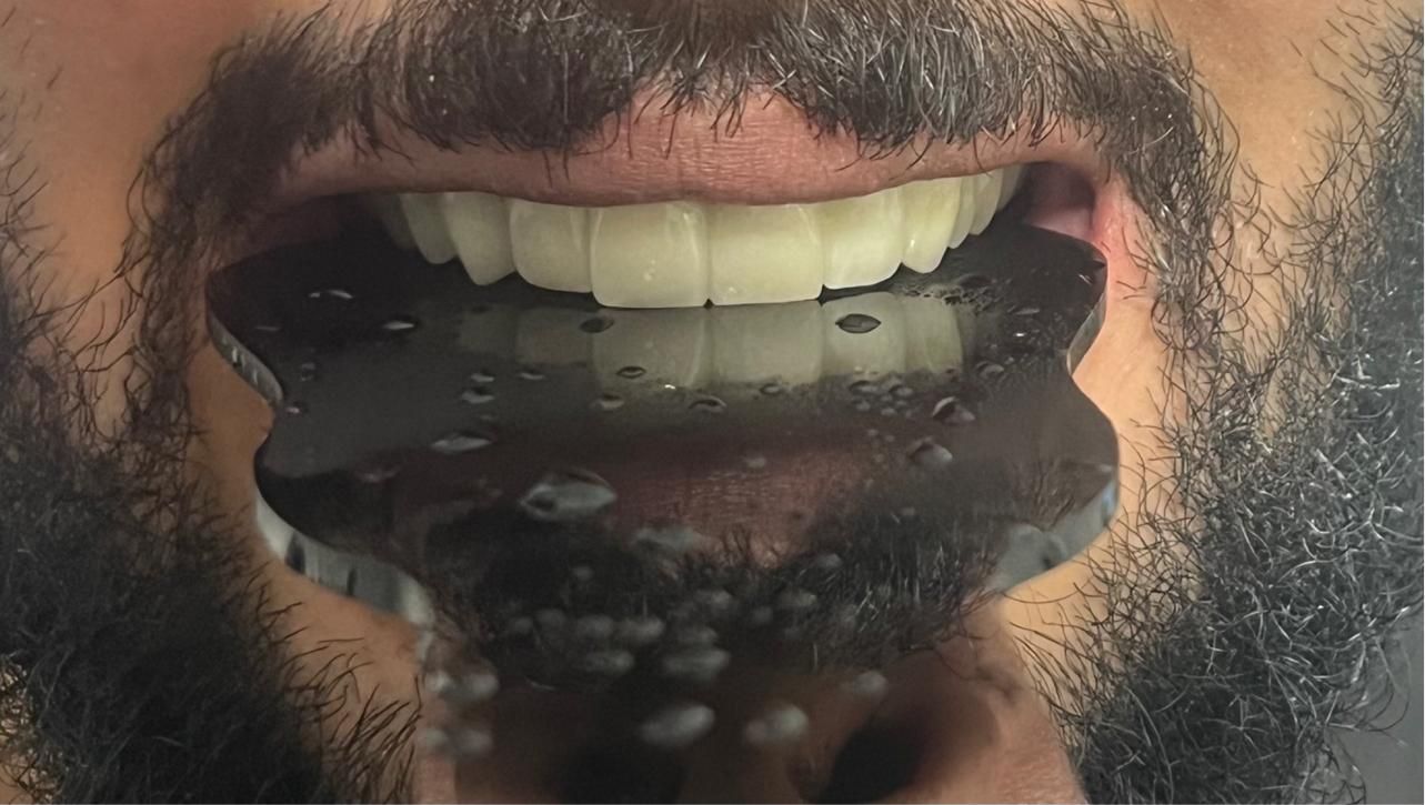 دندان سازی|خدمات آرایشگری و زیبایی|خوی, |دیوار