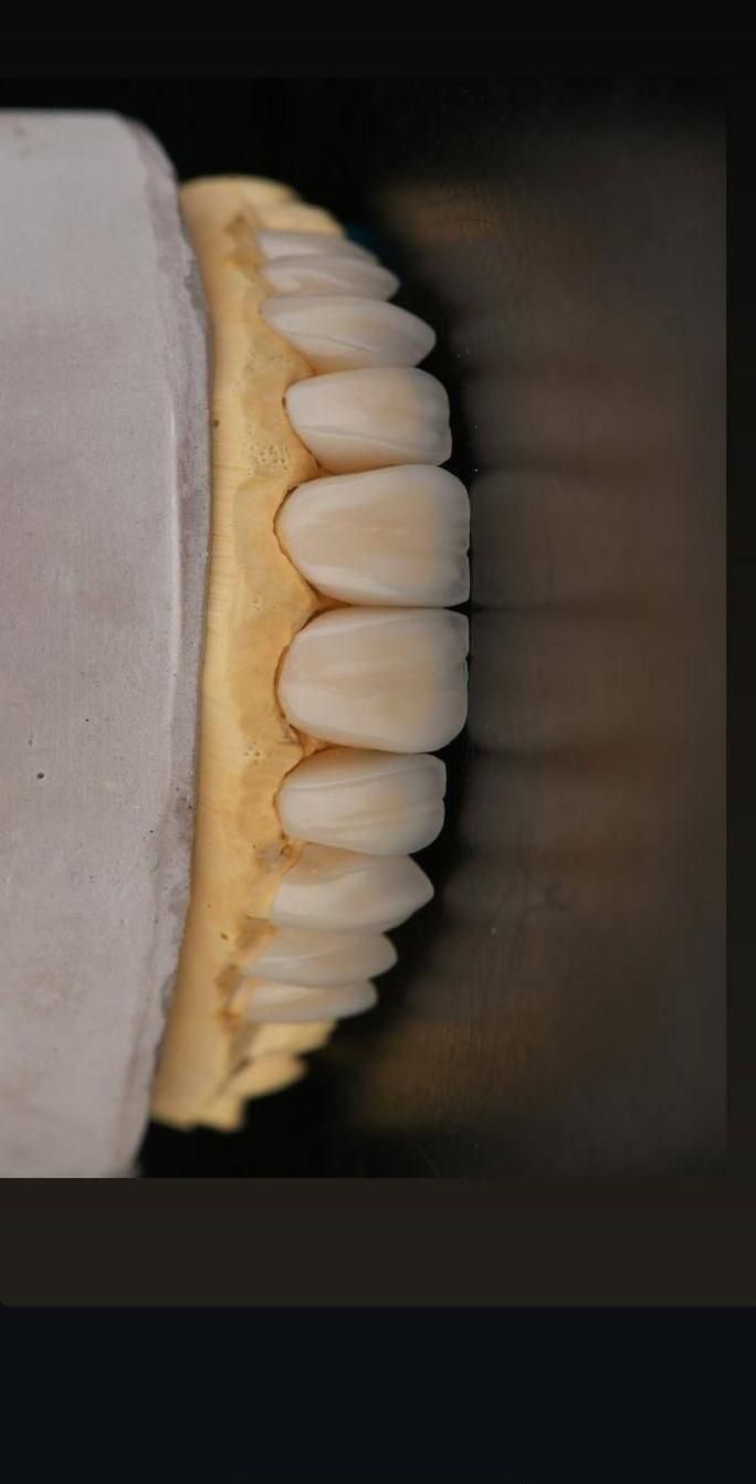 لابراتوار پروتزهای دندانی ثابت|پزشکی|نسیمشهر, |دیوار