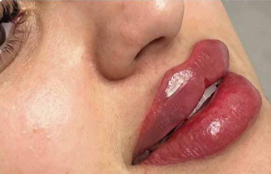 خدمات ژل و بوتاکس بانوان و آقایان|خدمات آرایشگری و زیبایی|پرند, فاز ۵|دیوار